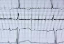 maximize online velocity pulse